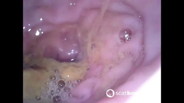 Show Inside Of My Ass With Endoscope [FullHD 1080p] Scatbook.com