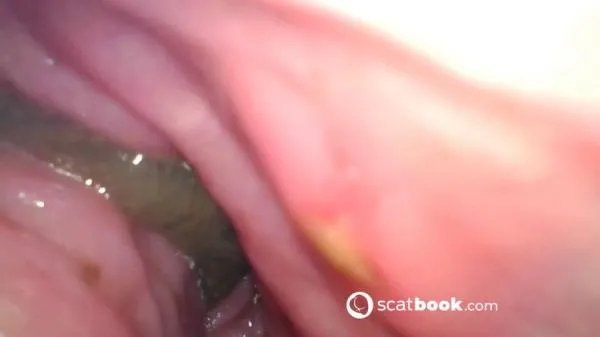 Endoscope In My Ass [FullHD 1080p] Scatbook.com