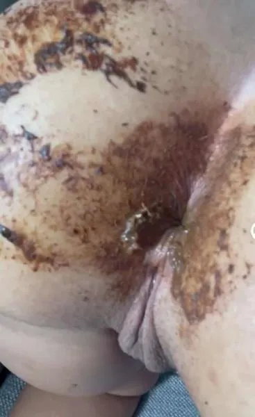 Aftermath of last video [HD 720p] Stuhlgang Porno